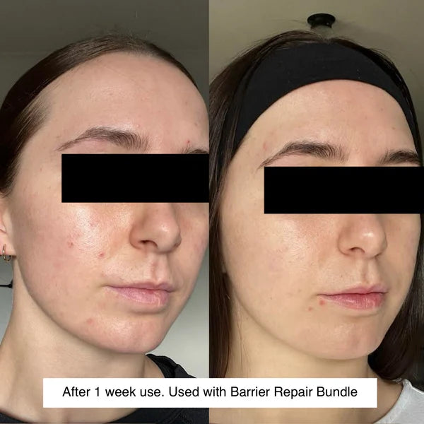 Barrier Repair Serum Gaia Uncovered *NEW*