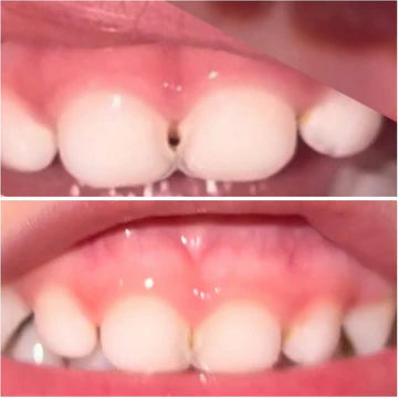 Remineralizing Tooth Puddy | Bliss Energetics